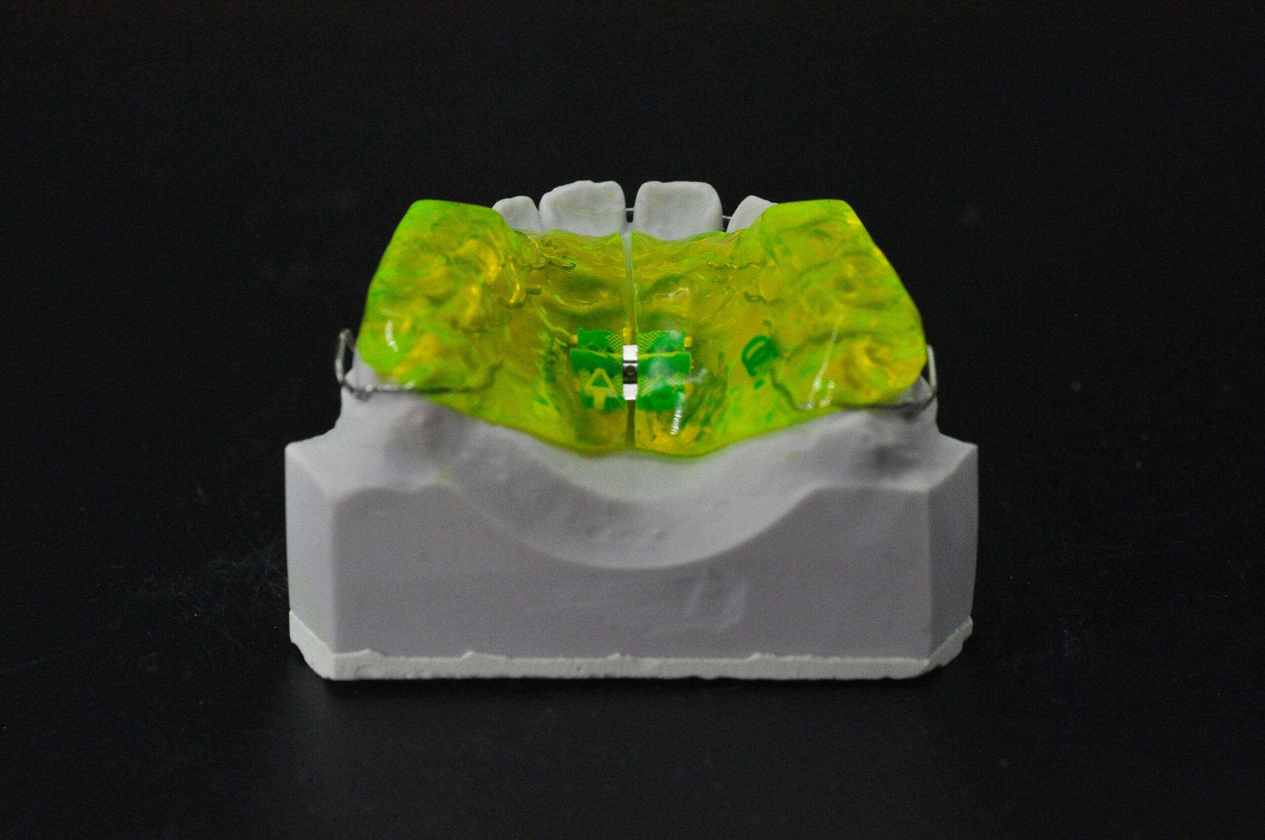 Twin-Block | Odontotecnica Castellana