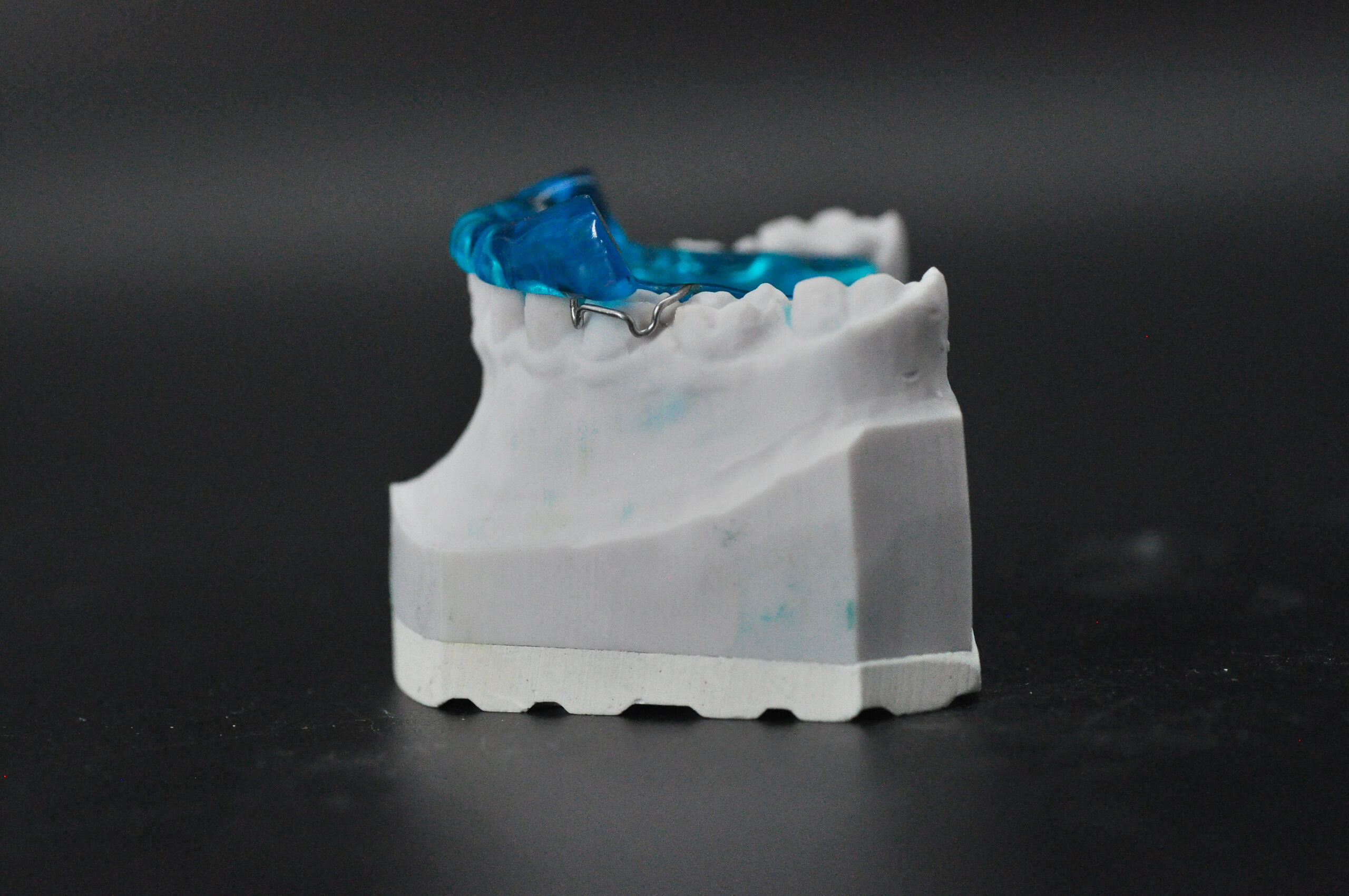 Twin-Block | Odontotecnica Castellana