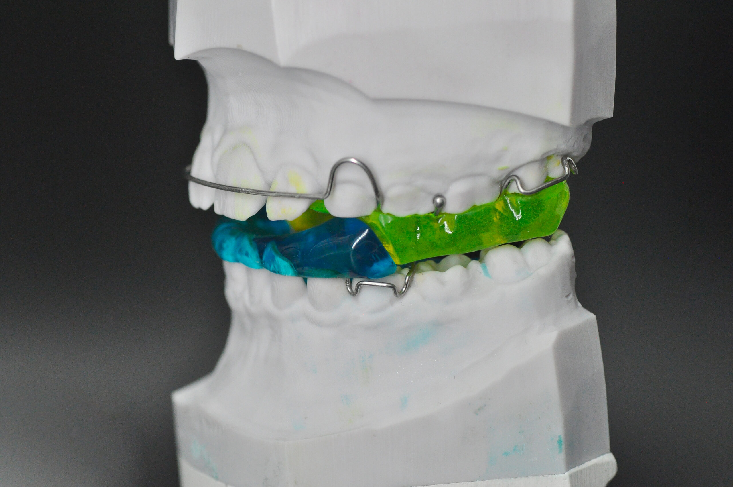 Twin-Block | Odontotecnica Castellana