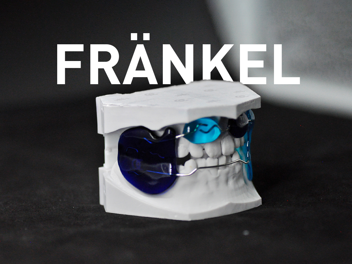 Frankel - Odontotecnica Castellana