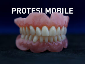 Protesi mobile totale - Odontotecnica Castellana