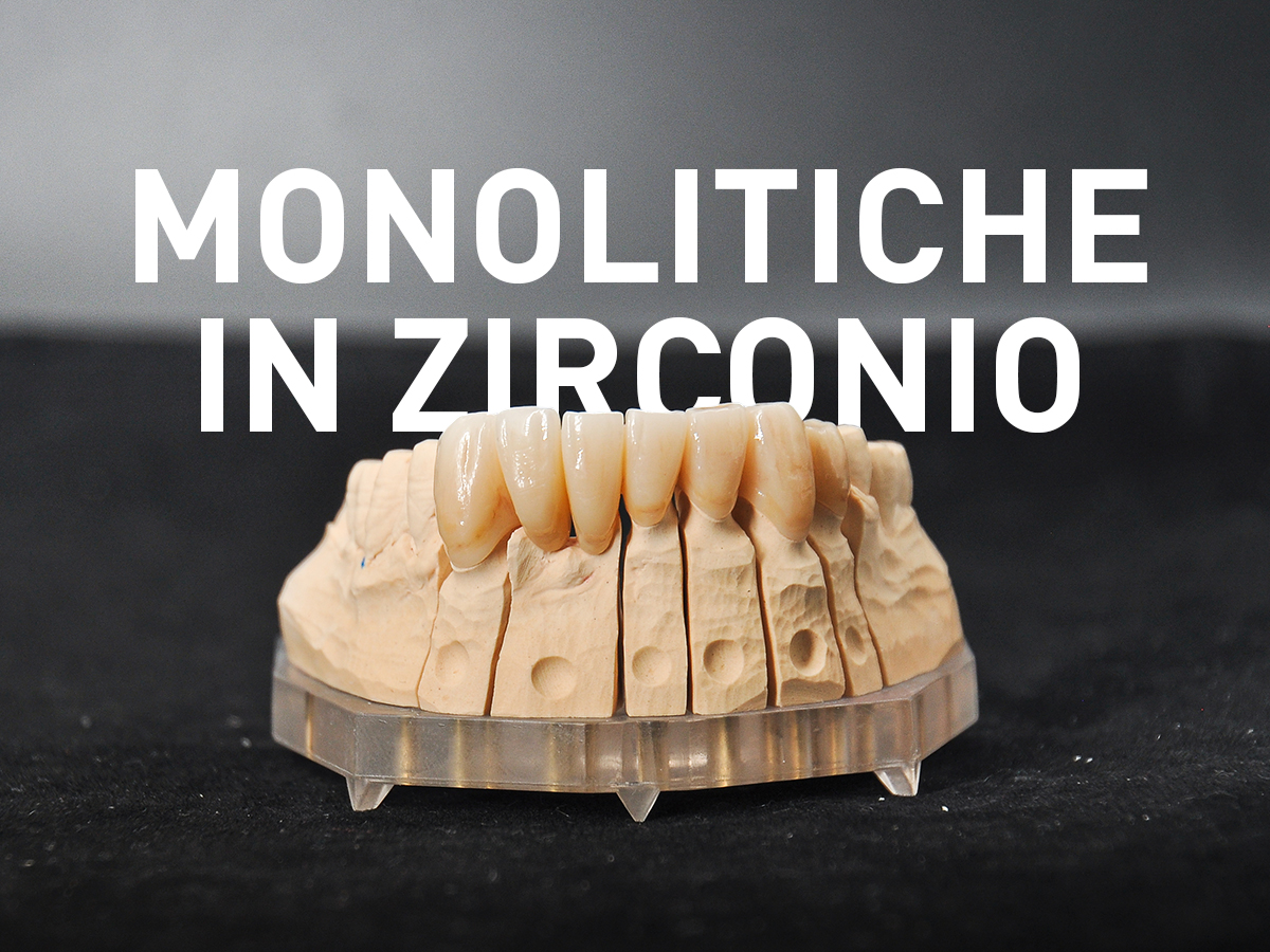 Ponte monolitico in Zirconio fresato in multilayer - Odontotecnica Castellana