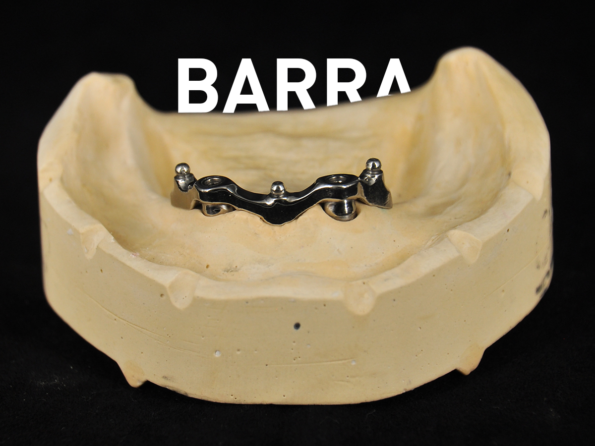 Barra - Odontotecnica Castellana